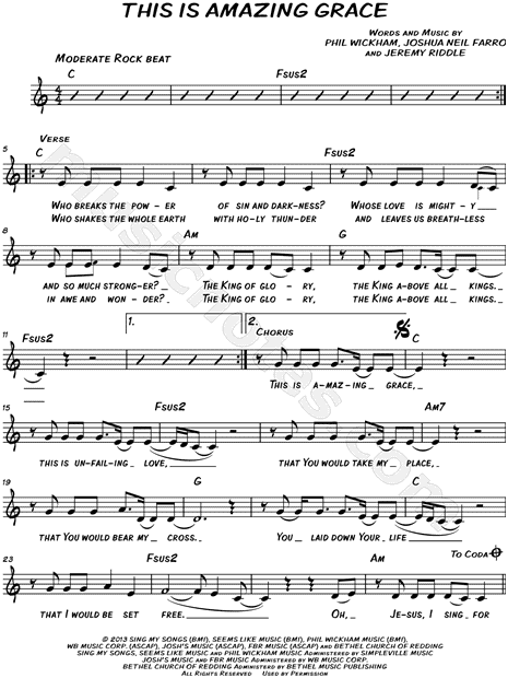 This Is Amazing Grace