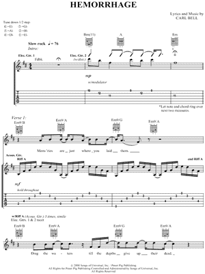 Hemorrhage (In My Hands)